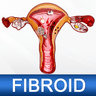 Uterine Fibroid Treatment Help icon